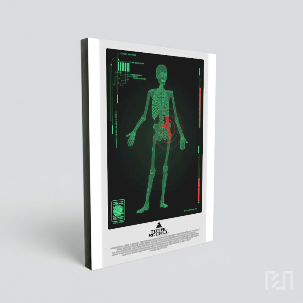 Total Recall Federal Colonies X-Ray Scan