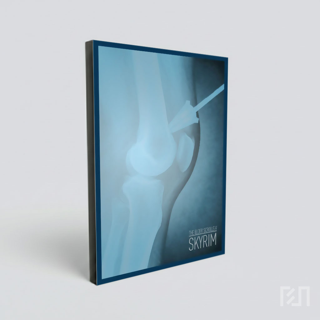 X-Ray Lutut dengan Panah di Lutut Skyrim